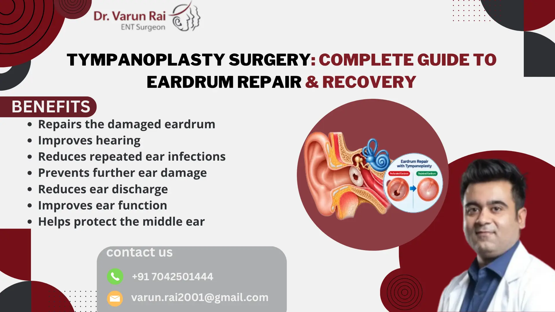 Tympanoplasty Surgery