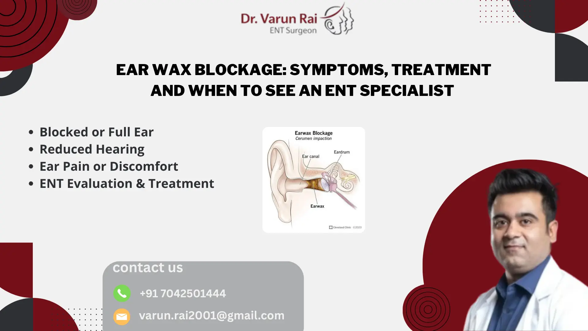 Earwax Blockage: Causes & Quick Relief Tips